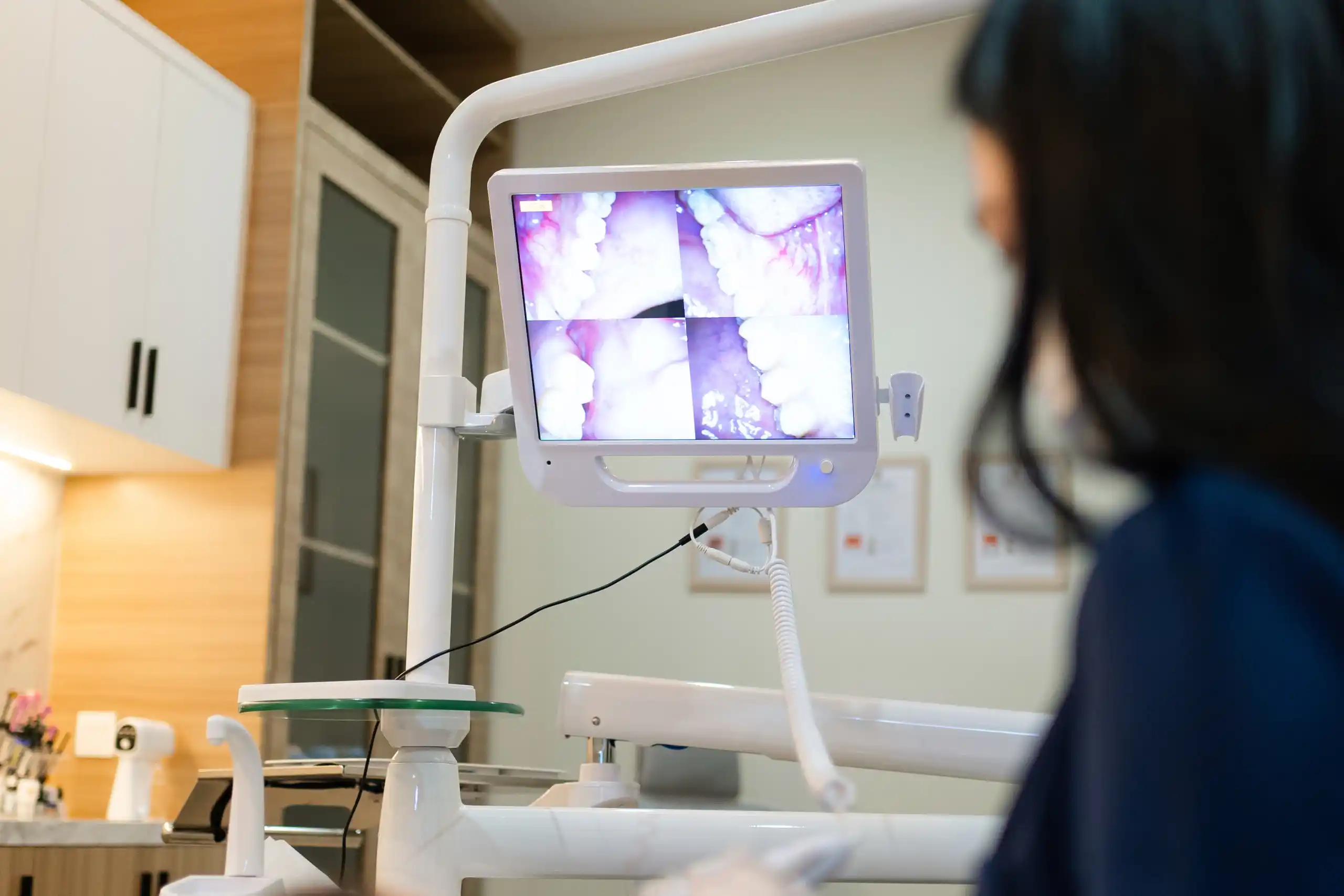 Solusi Gigi Sensitif di Klinik Gigi Denpasar