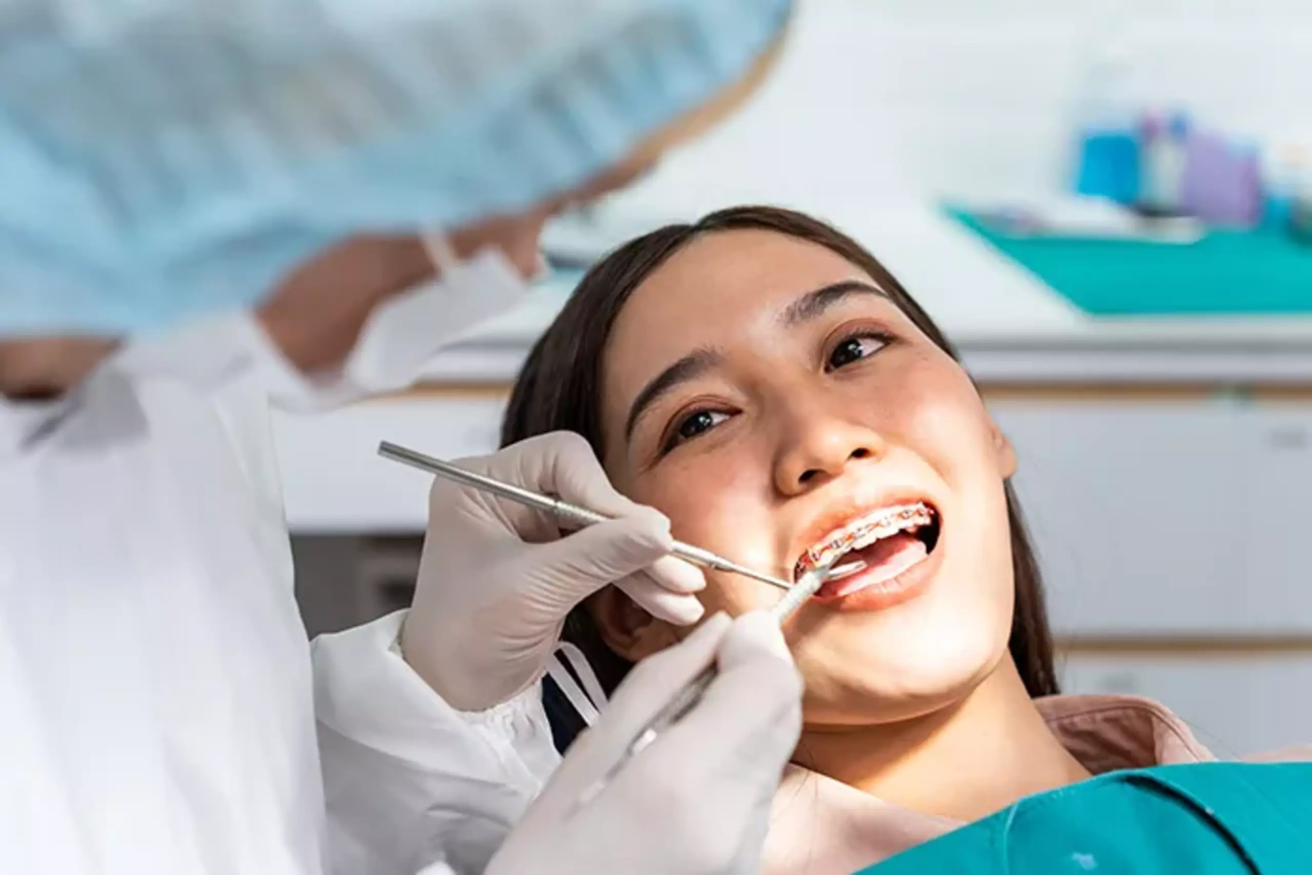 Pasang Kawat Gigi Hingga Scaling di Klinik Gigi Denpasar