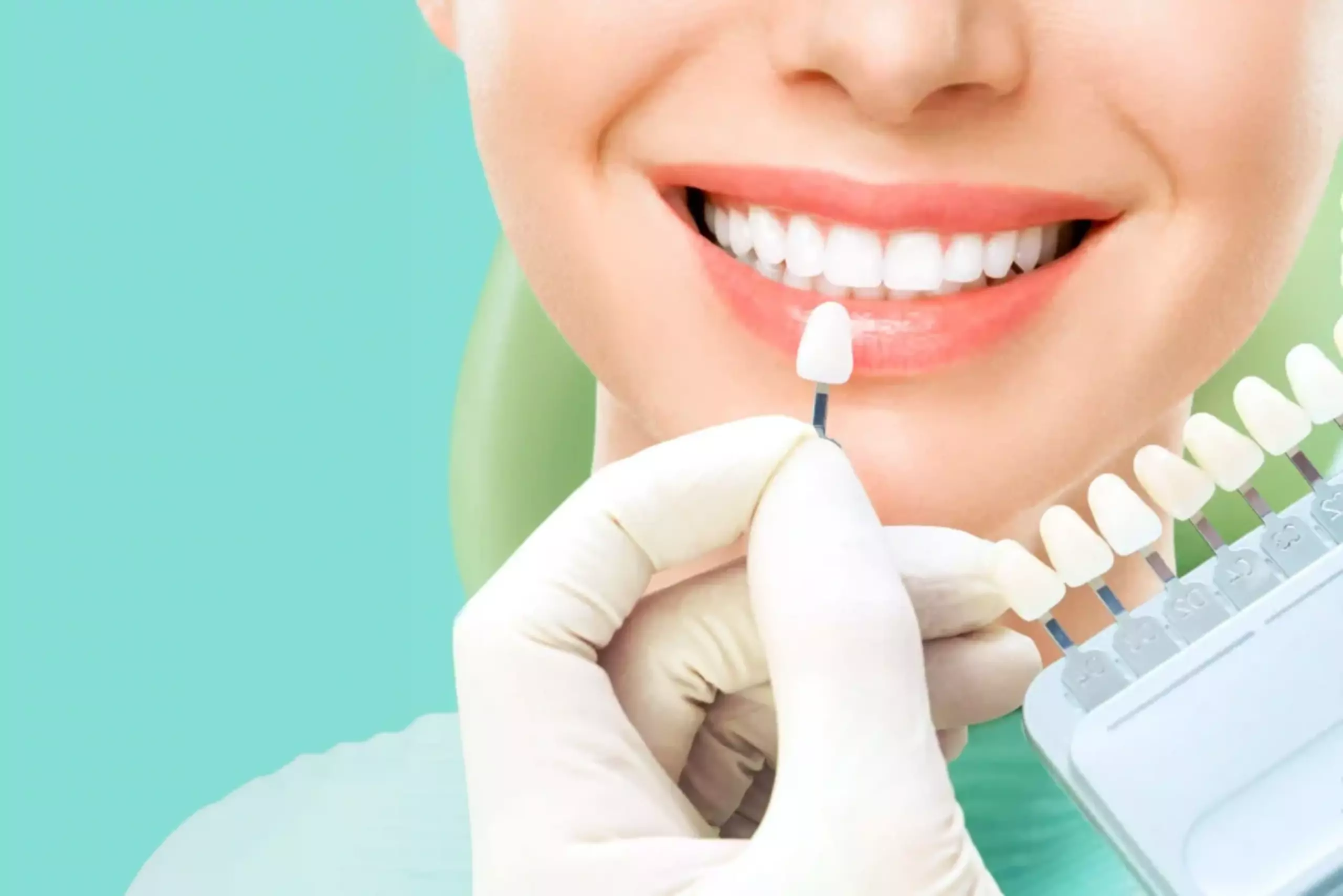 Ciptakan Senyum Impian Anda dengan Pasang Veneer Gigi di Dokter Gigi Terdekat di Bali