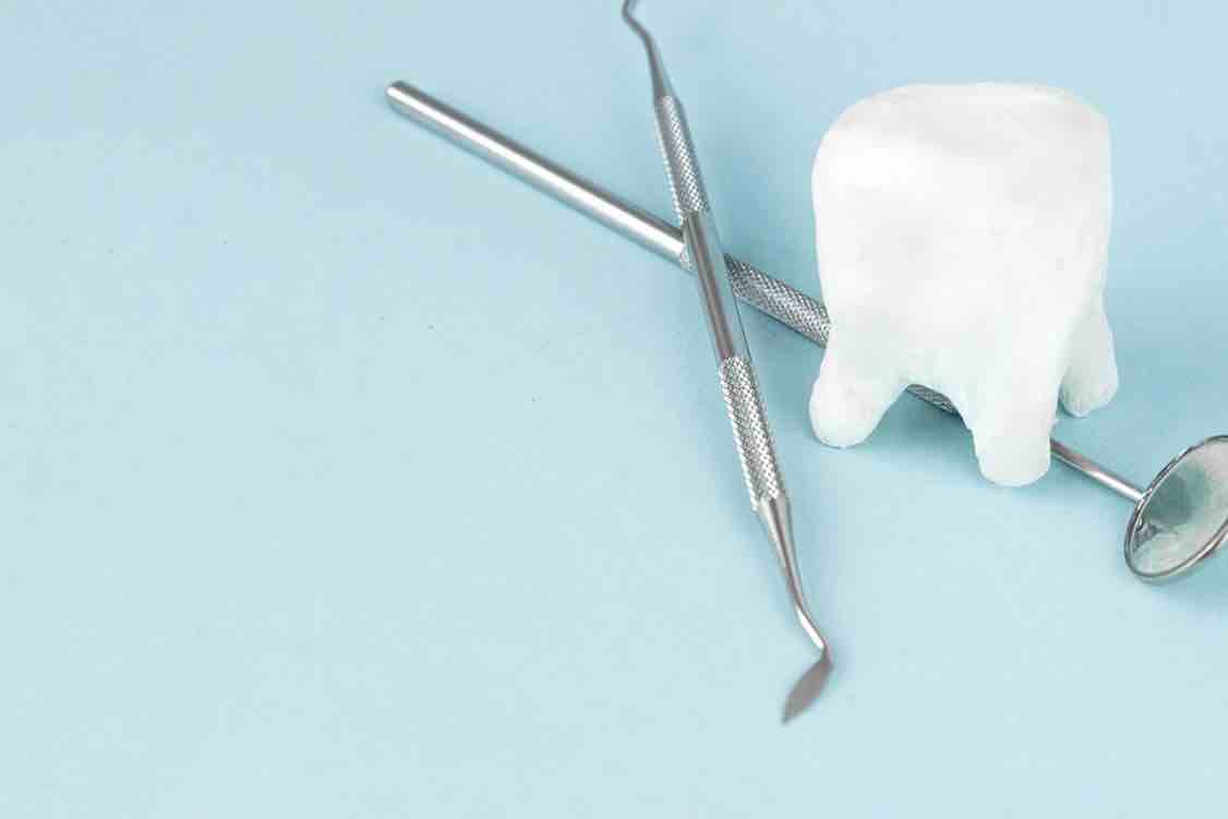 Tips Memilih Klinik Gigi yang Terpercaya di Bali