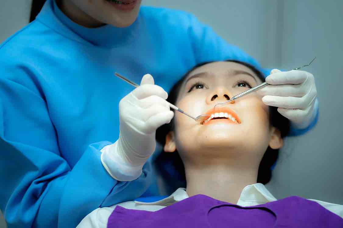 Jasa Veneer Gigi Terbaik di Bali