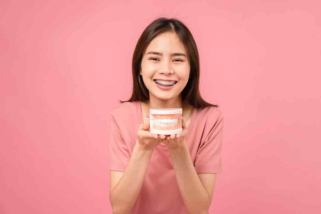 Teeth Whitening Aman dan Efektif untuk Gigi Lebih Putih