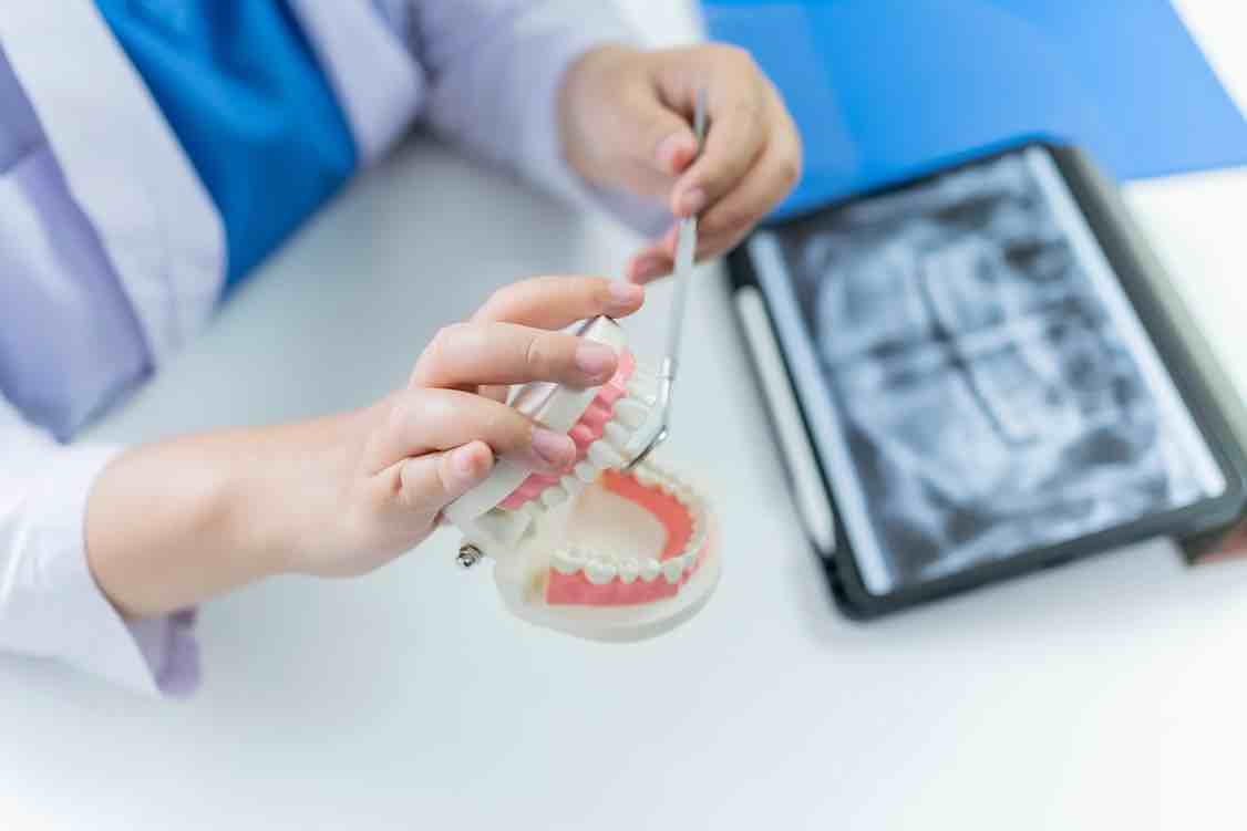 Perbedaan Braces dan Clear Aligner yang Harus Anda Ketahui