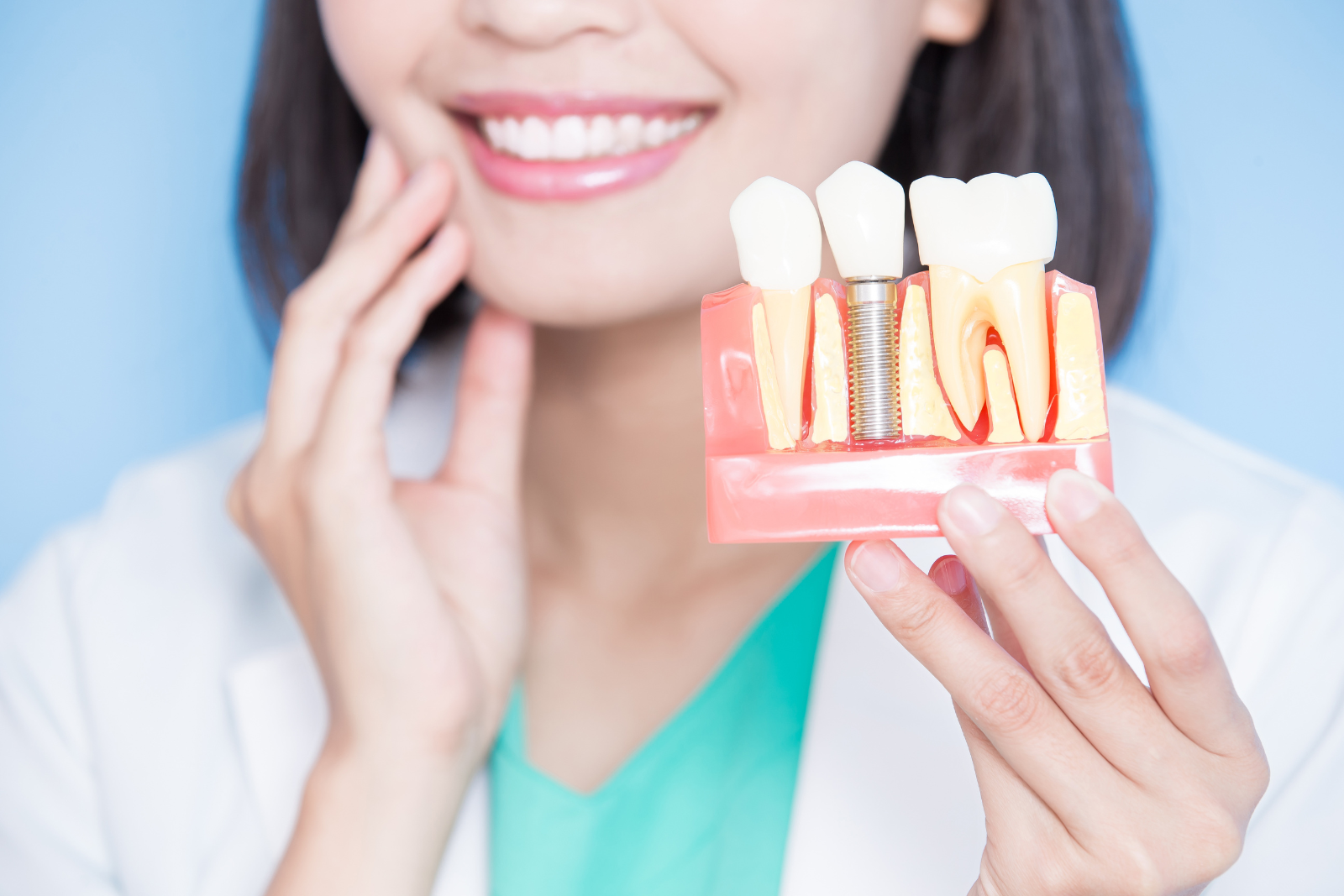 5 Kebiasaan yang Buat Gigi Implant Kamu Cepat Rusak