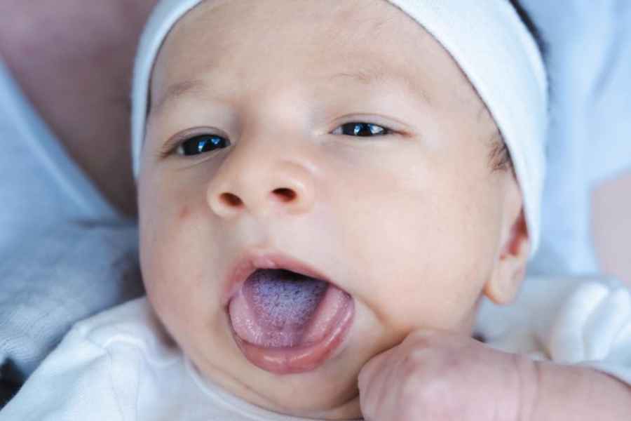 Cara Aman Membersihkan Lidah Bayi