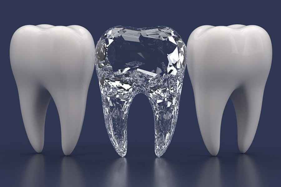 Cara Rawat Diamond Teeth