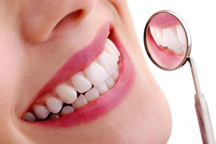 Ciri Gigi dan Mulut yang Sehat