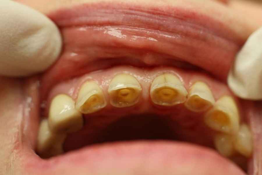 Kelainan Gigi yang Perlu Kamu Waspadai