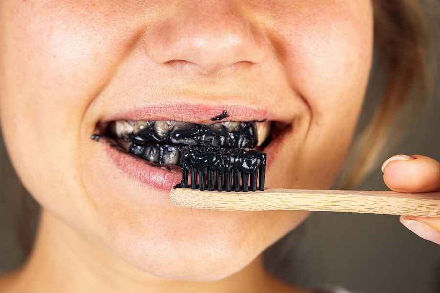 Bahaya Produk Pemutih Instan untuk Gigi