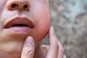 Cara Aman Meredakan Nyeri Gusi