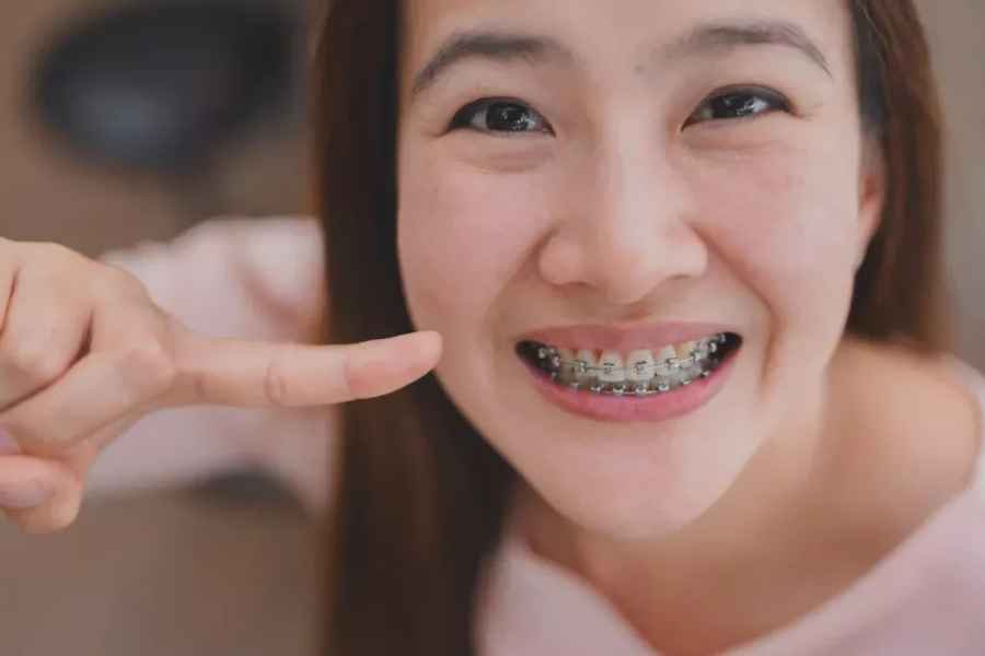 cara efektif rawat kebersihan behel gigi